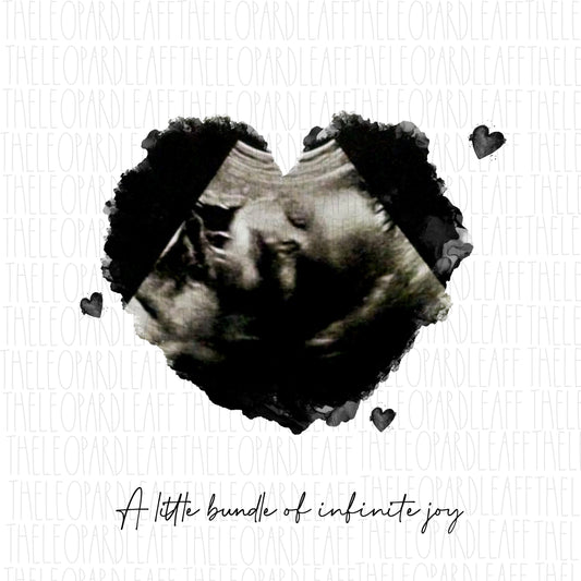 Baby ultrasound art,baby sonogram,sonogram art ***DIGITAL DESIGN*** jpeg png file