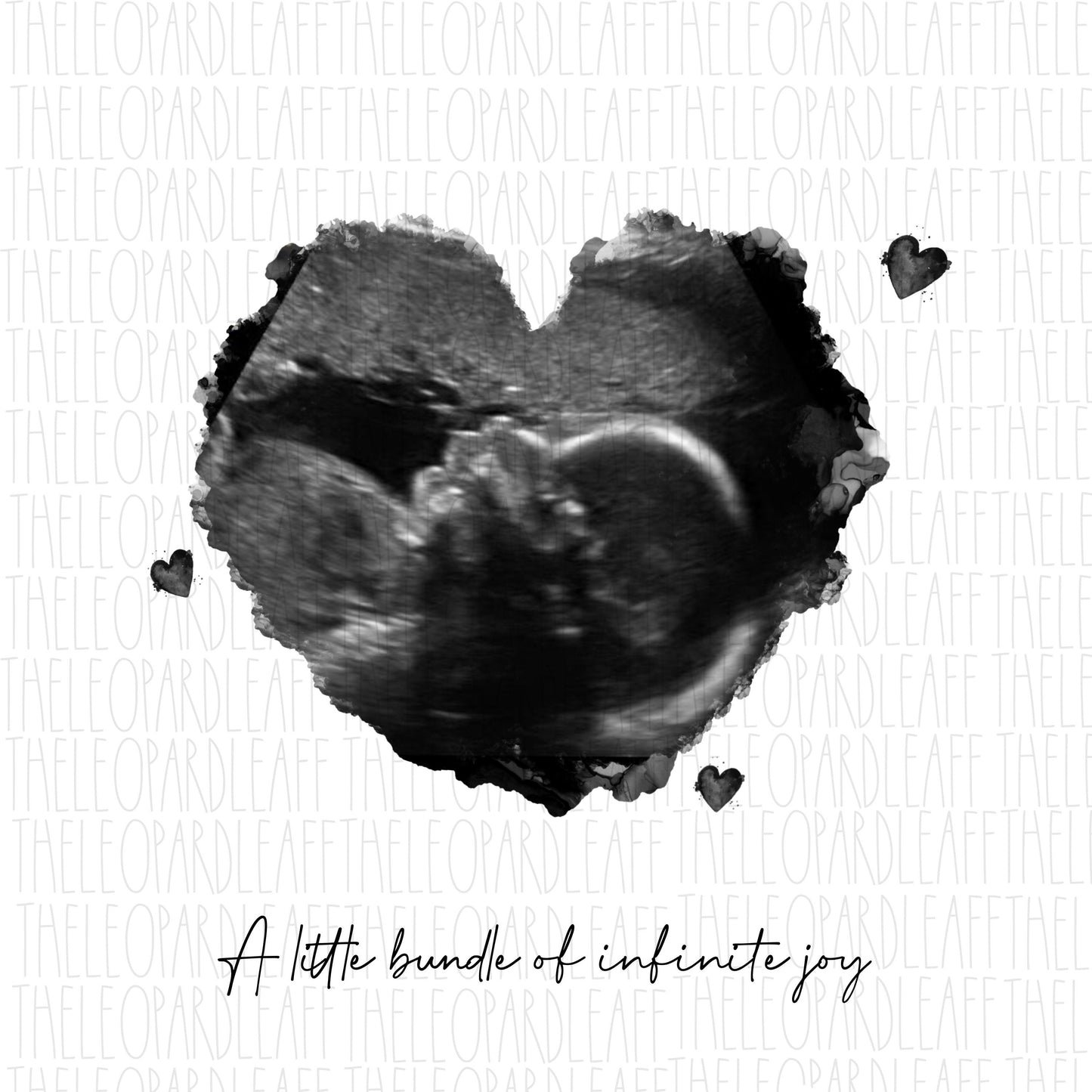 Baby ultrasound art,baby sonogram,sonogram art ***DIGITAL DESIGN*** jpeg png file